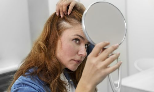 Quais são os motivos mais comuns da queda de cabelo?